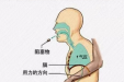 生命急救，“救”在身边的海姆立克