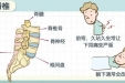 久坐久站腰就痛，康复医学科教你运动治疗腰痛