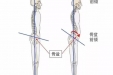 “前凸后翘”好身材？当心骨盆前倾哟！