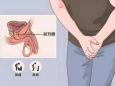 春节娱乐有度，莫让久坐伤了前列腺