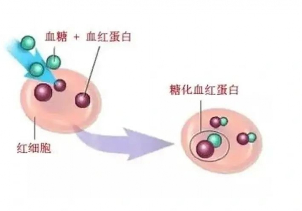 糖化血红蛋白是什么？