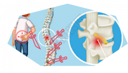 你的脊柱在喊“救命啊!”