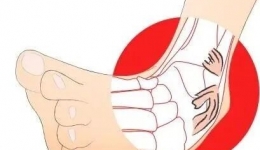 踝关节反复扭伤？可以这么治→