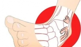 踝关节反复扭伤？可以这么治→