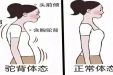 愁坏家长！娃娃体态越来越差咋整？康复医学门诊：科学纠正，比你唠叨管用