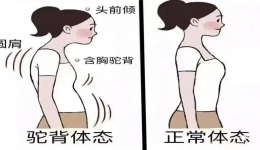 愁坏家长！娃娃体态越来越差咋整？康复医学门诊：科学纠正，比你唠叨管用