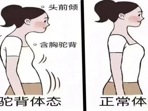 愁坏家长！娃娃体态越来越差咋整？康复医学门诊：科学纠正，比你唠叨管用