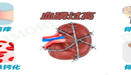 血液透析后皮肤瘙痒、脚抽筋？要警惕高磷血症！