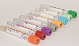 检查抽N管血，会不会导致贫血？