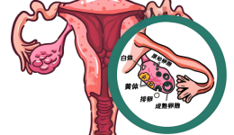 【女生必看】比痛经更可怕的，是月经周期中的这种“撕裂痛”！