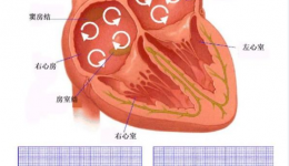 房颤不是 “小毛病”！抗凝治疗帮你远离中风风险