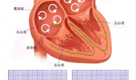 房颤不是 “小毛病”！抗凝治疗帮你远离中风风险