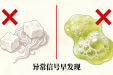 别害羞！白带常规，每个女性都该了解的健康项