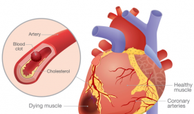 突发胸痛别慌！这份自救指南 + 就诊攻略请收好