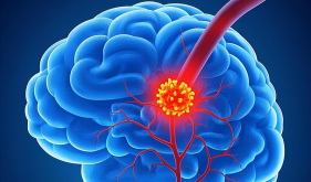 【健康科普・医路护航】冬季，为何脑梗容易找上门？