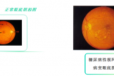 【健康科普・医路护航】糖尿病视网膜病变，糖友必看的眼底 “隐形杀手”